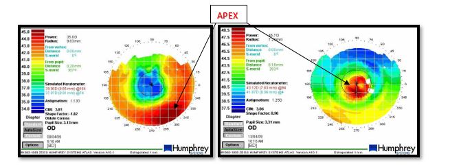 HVID Measurements